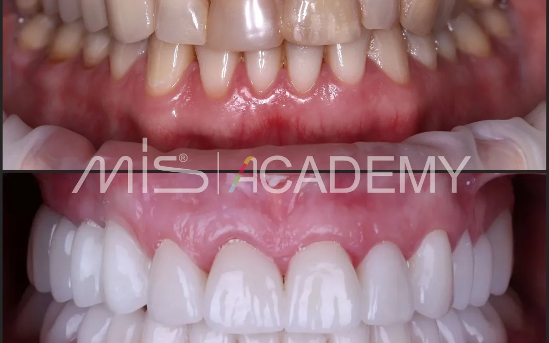 Татьяна Ковалева | Клинический кейс TK-02