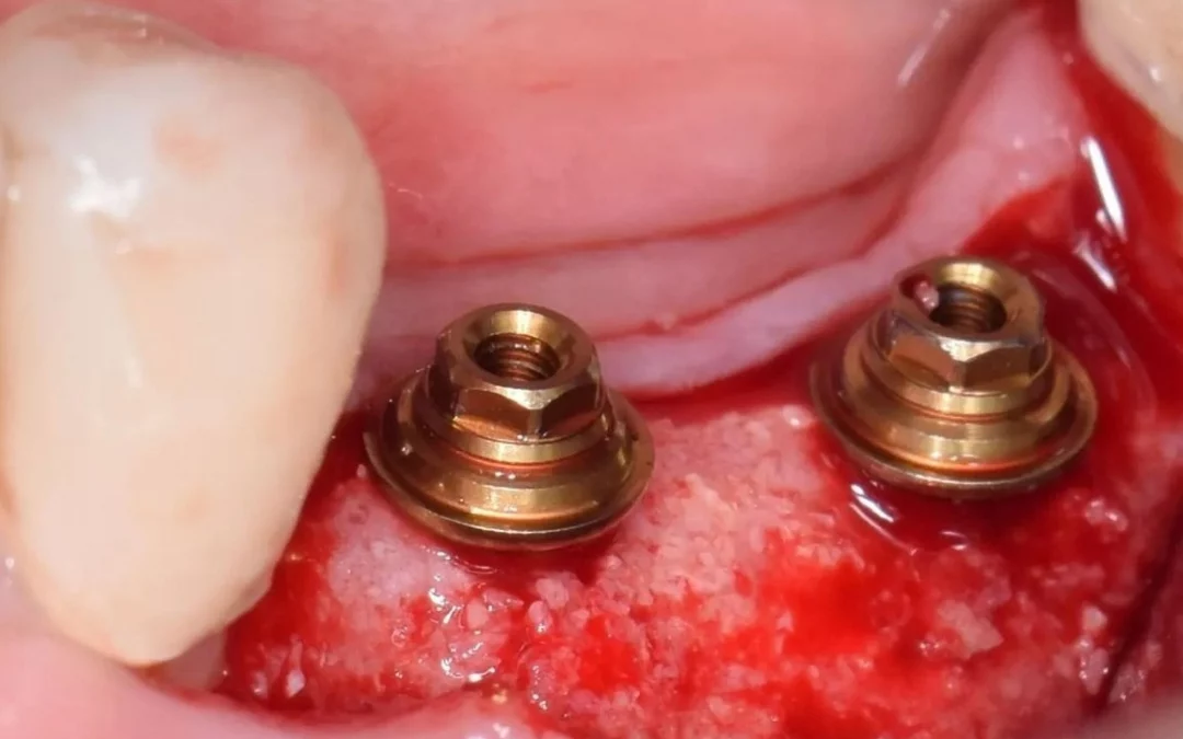 Татьяна Ковалева | Клинический кейс TK-04