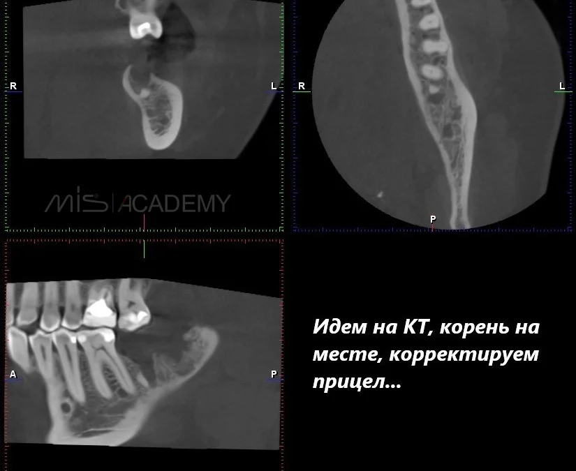 Владимир Данилов | Клинический кейс VD-12