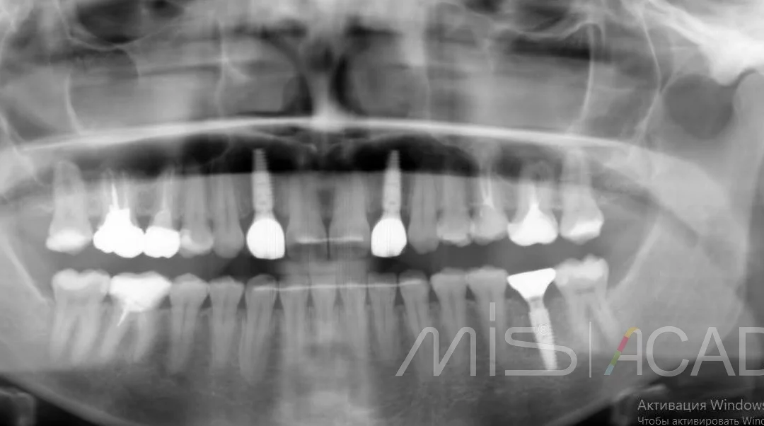Ренат Ризванов | Клинический кейс RR-40
