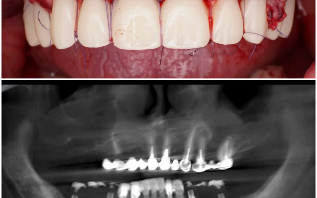 Ренат Ризванов | Клинический кейс RR-41