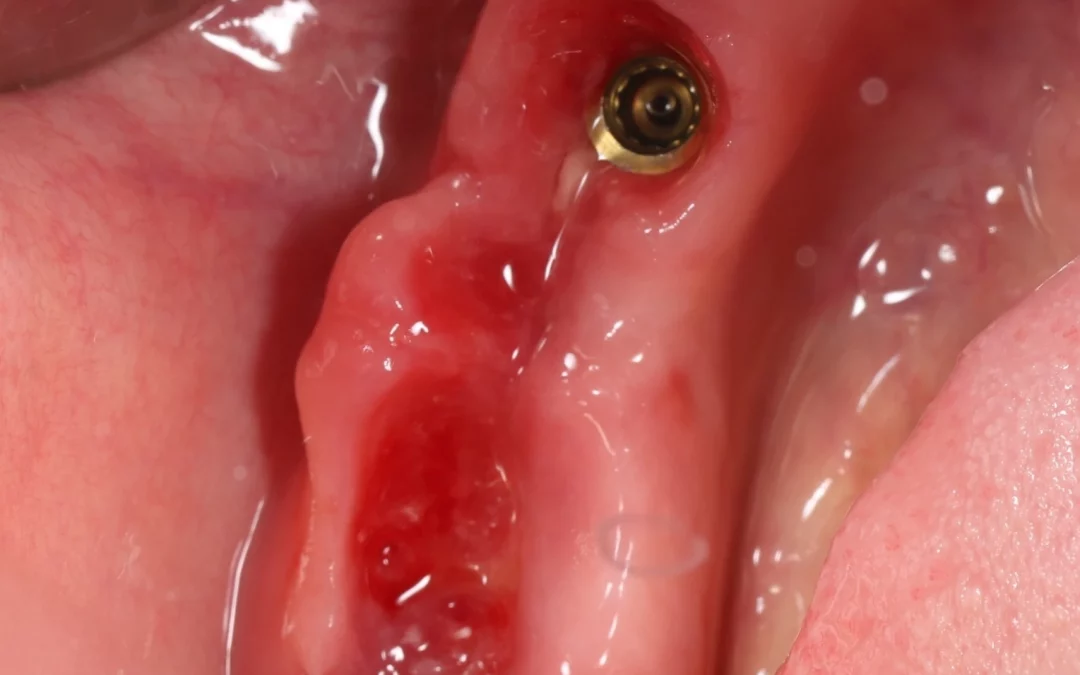 Махмуд Мазлум | Клинический кейс MM-12