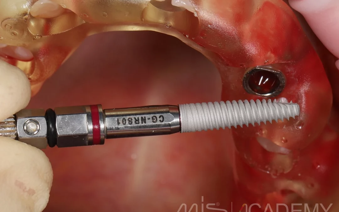 Махмуд Мазлум | Клинический кейс MM-08