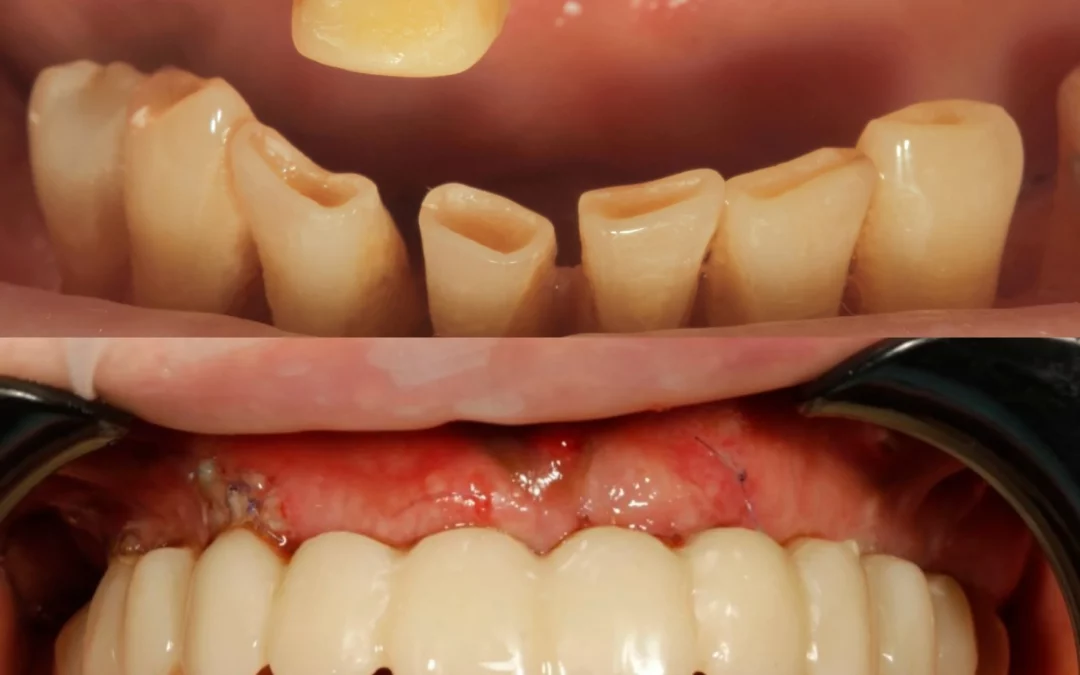 Александр Зак | Клинический кейс AZ-28