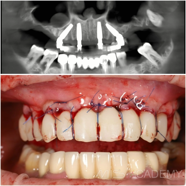 Махмуд Мазлум | Клинический кейс MM-09