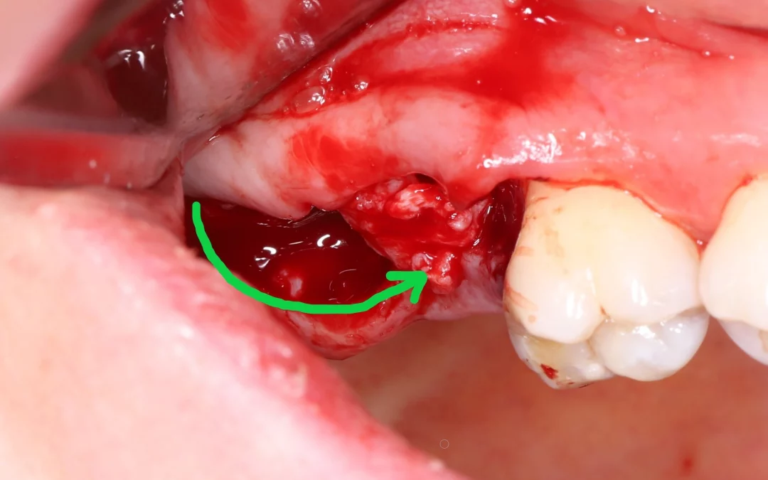 Владимир Данилов | Клинический кейс VD-25