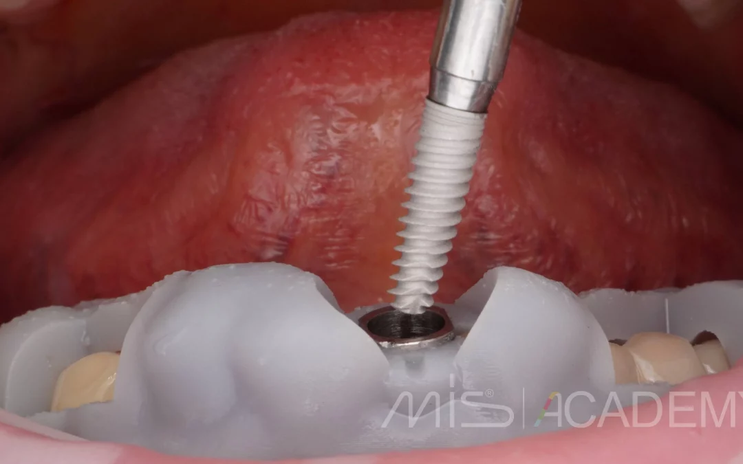 Ренат Ризванов | Клинический кейс RR-42