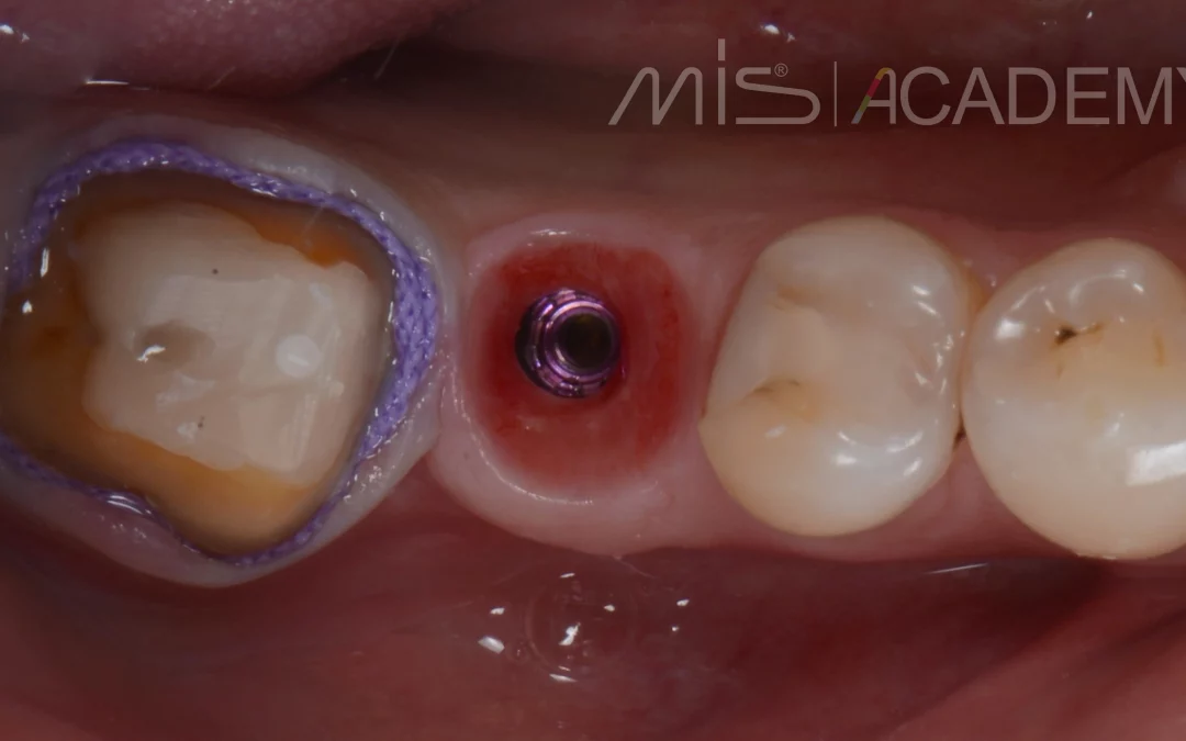 Василий Бочаров | Клинический кейс VB-61