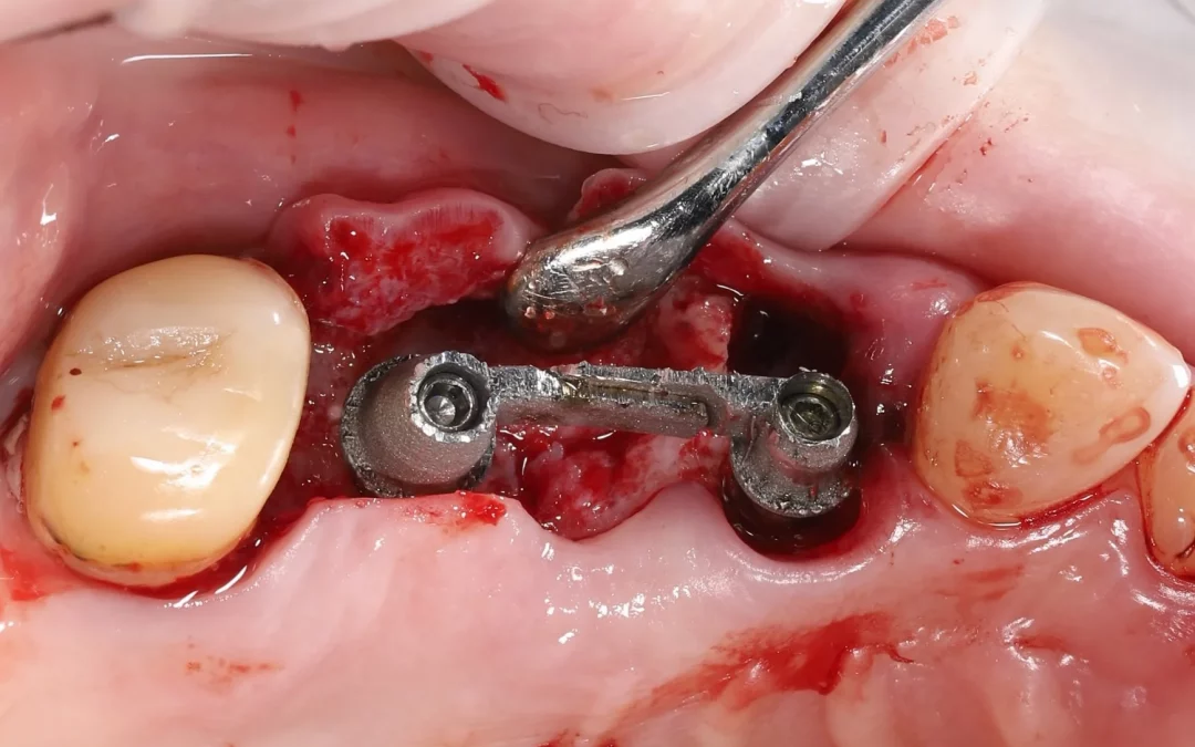 Махмуд Мазлум | Клинический кейс MM-07