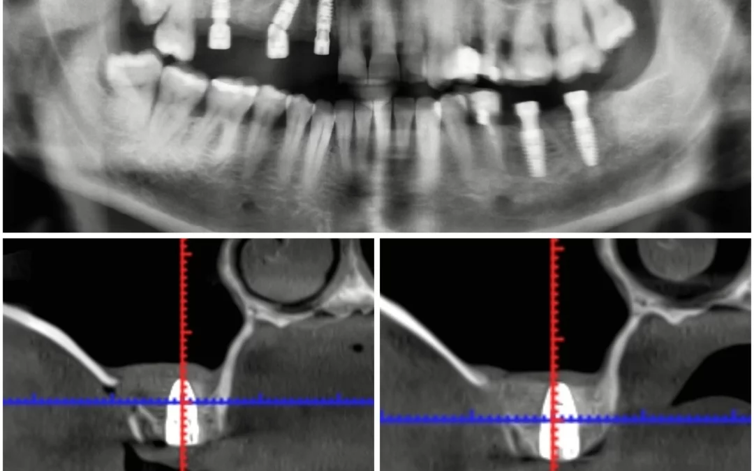 Махмуд Мазлум | Клинический кейс MM-10