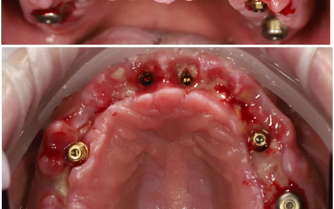 Махмуд Мазлум | Клинический кейс MM-13