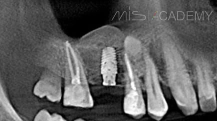 Александр Зак | Клинический кейс AZ-27