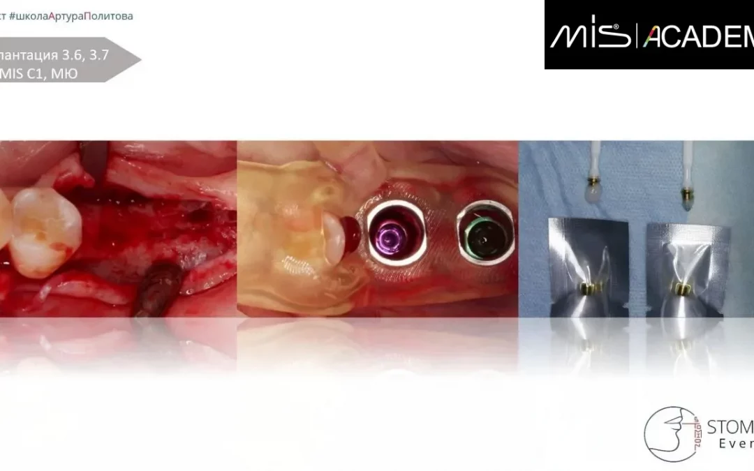 Артур Политов | Клинический кейс AP-76