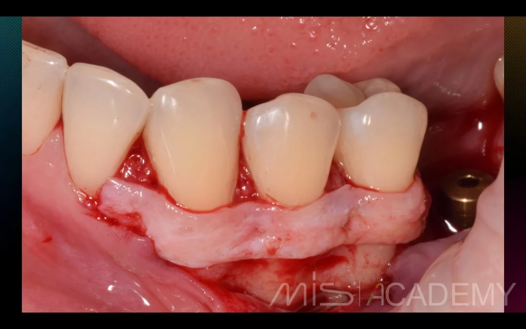 Татьяна Ковалева | Клинический кейс TK-71