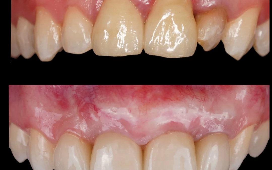 Юрий Гузеев | Клинический кейс YG-130