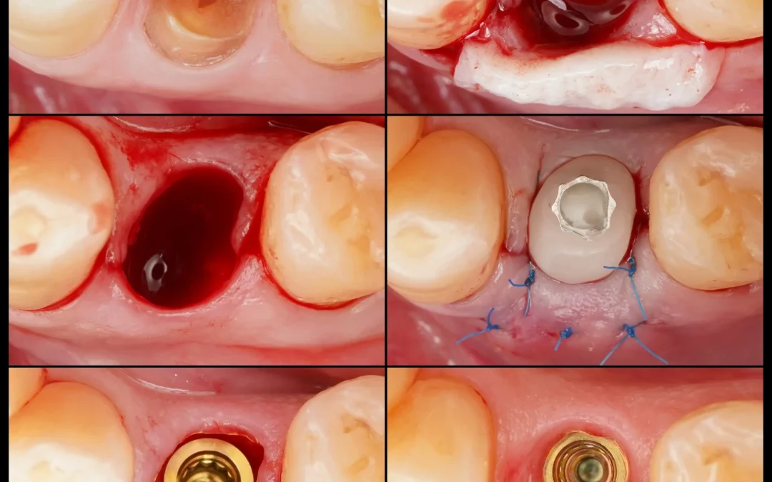 Юрий Гузеев | Клинический кейс YG-132