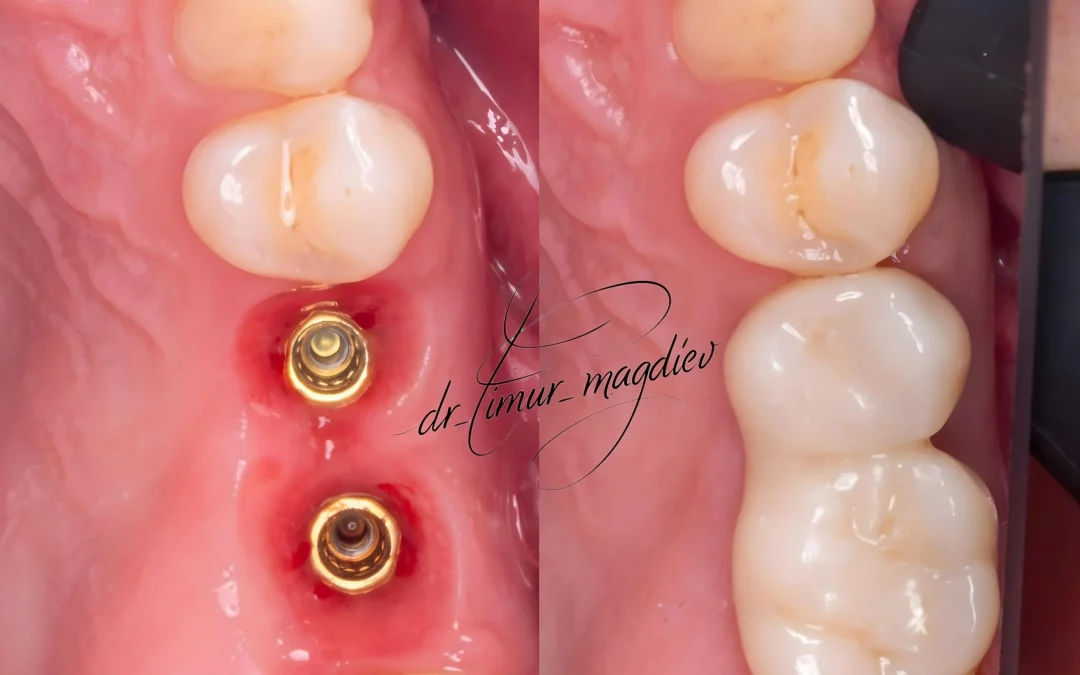 Тимур Магдиев | Клинический кейс TM-84