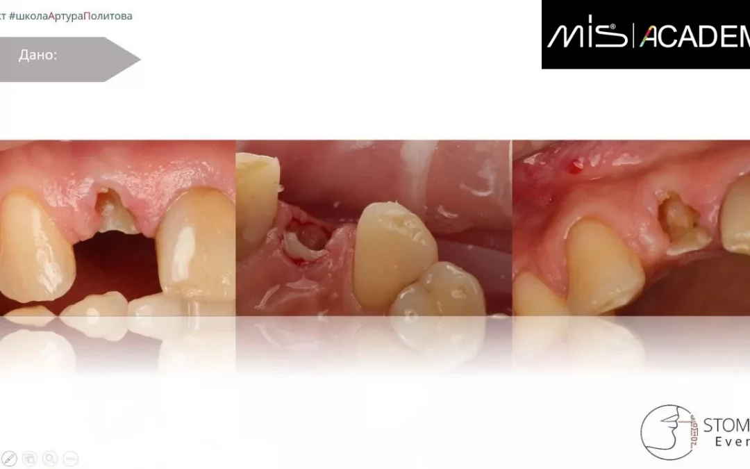 Артур Политов | Клинический кейс AP-78