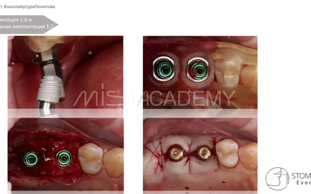 Артур Политов | Клинический кейс AP-81