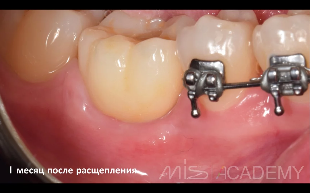 Татьяна Ковалева | Клинический кейс TK-73