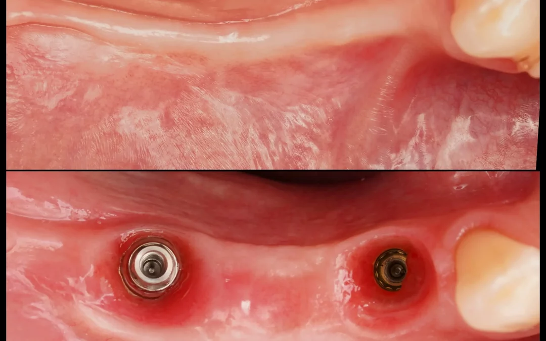 Юрий Гузеев | Клинический кейс YG-131