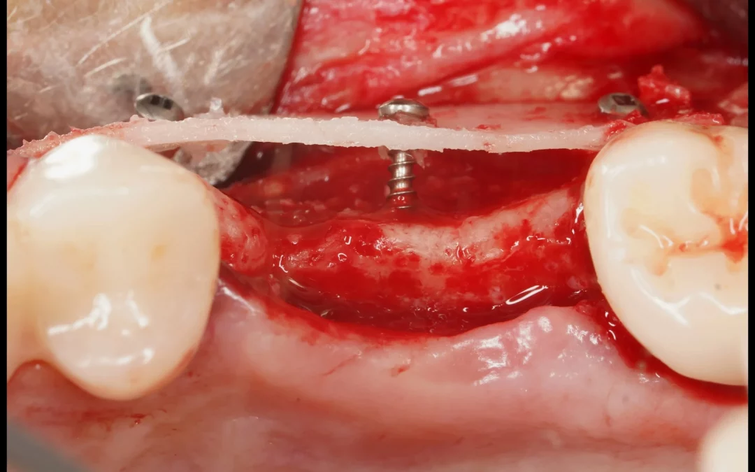 Юрий Гузеев | Клинический кейс YG-129