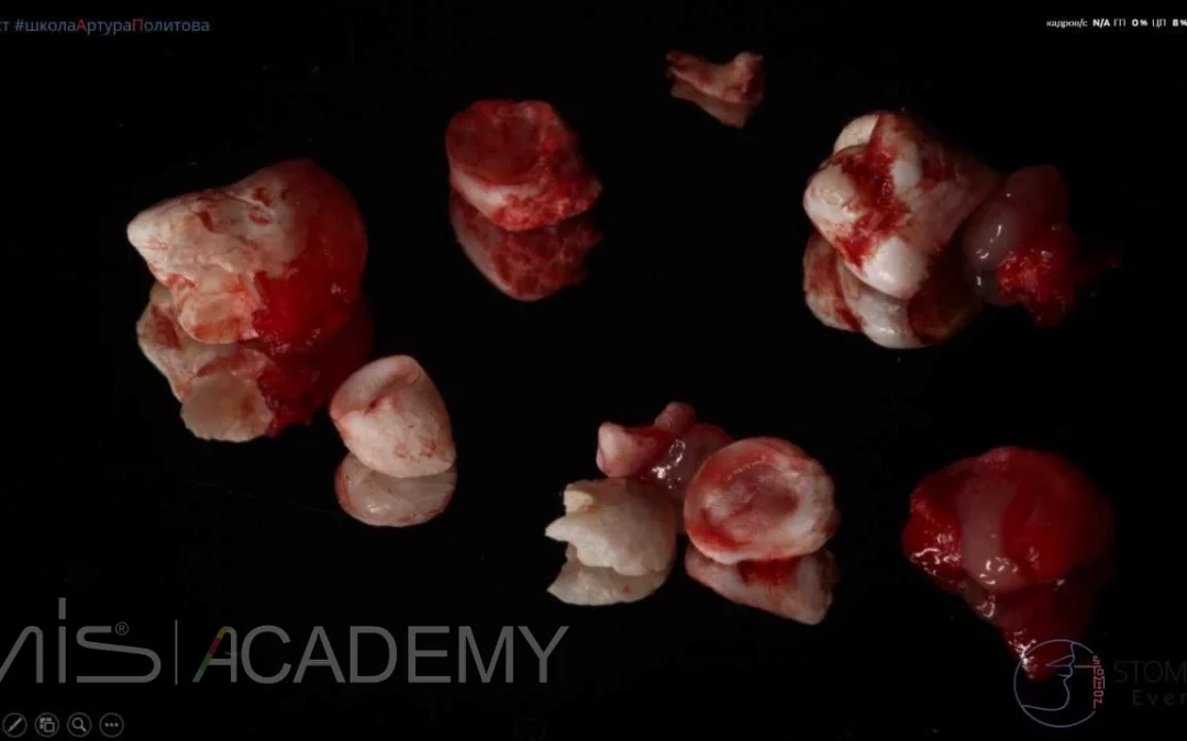 Артур Политов | Клинический кейс AP-79