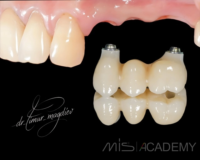 Тимур Магдиев | Клинический кейс TM-85