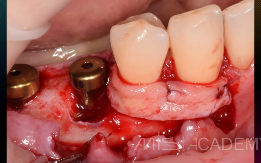 Татьяна Ковалева | Клинический кейс TK-72