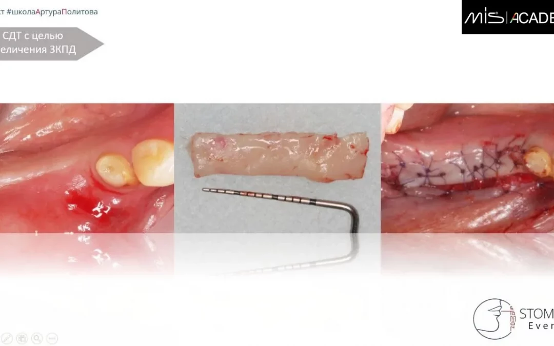 Артур Политов | Клинический кейс AP-80