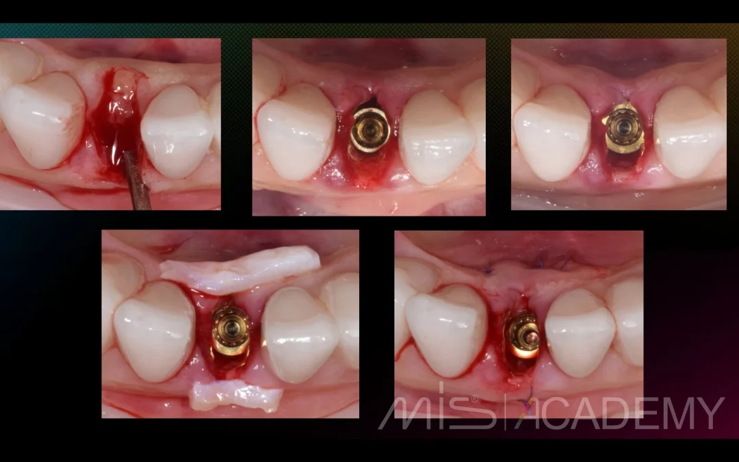 Татьяна Ковалева | Клинический кейс TK-74