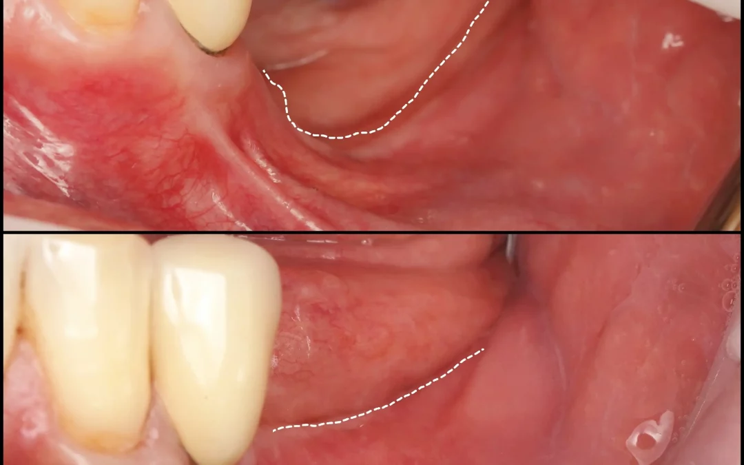 Юрий Гузеев | Клинический кейс YG-137