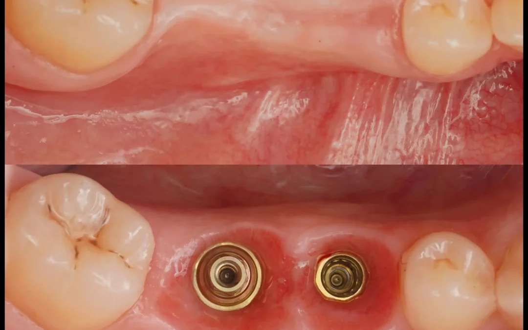 Юрий Гузеев | Клинический кейс YG-134