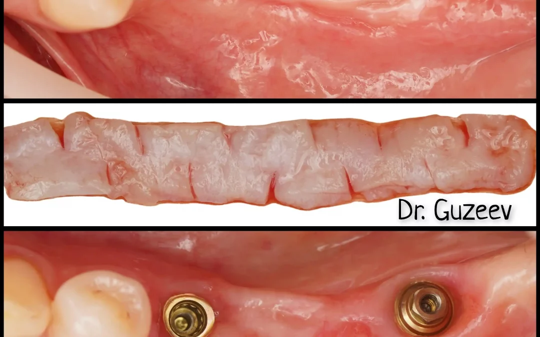 Юрий Гузеев | Клинический кейс YG-136