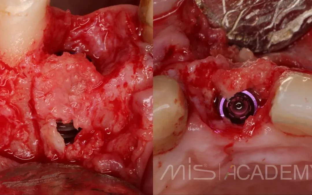 Елизавета Елевтерова | Клинический кейс EE-03