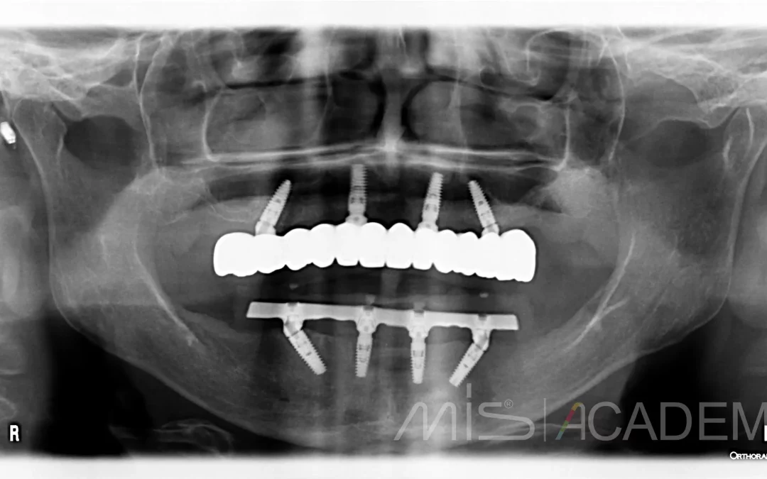 Василий Бочаров | Клинический кейс VB-65