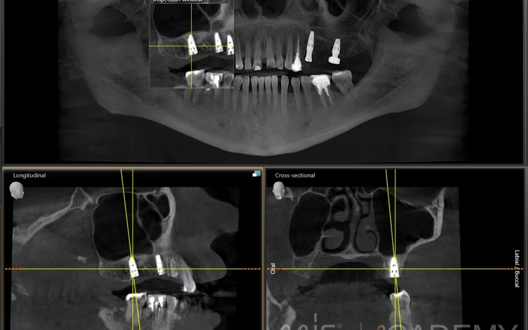 Василий Бочаров | Клинический кейс VB-62