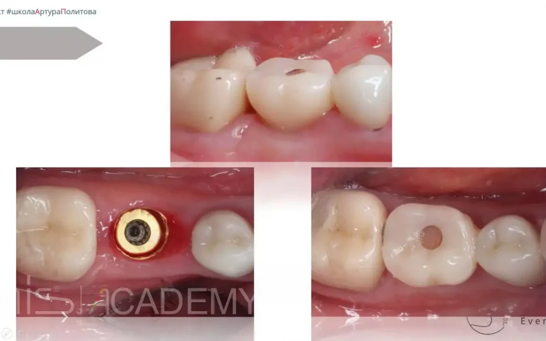 Артур Политов | Клинический кейс AP-83
